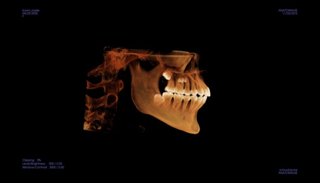 Cone beam 3d